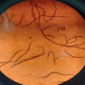 Nematodes_Apache 10G_Nematicide